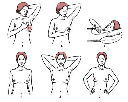 妇女保健知识——乳房自我检查的方法