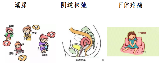 QQ图片20190328103140.png